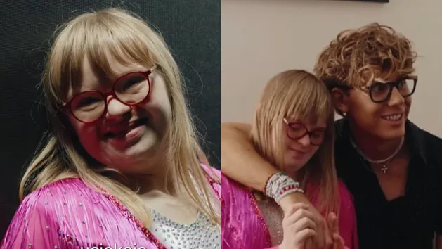 Bagi mówi o swojej siostrze z zespołem Downa: "Matylda jest moją największą inspiracją"