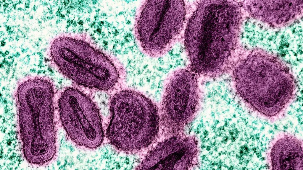 Nowa odmiana wirusa Mpox wykryta u osoby powracającej z Azji – co warto wiedzieć