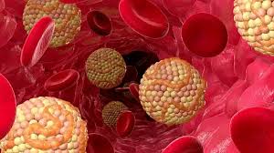 Wysoki cholesterol – przyczyny, porady, symptomy. Jak rozpoznać zagrożenie? Wysoki cholesterol – przyczyny, porady, symptomy. Jak rozpoznać zagrożenie?