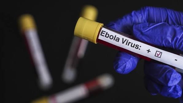 Ebola w Kongo 2026. Liczba ofiar rośnie, wirus dotarł do kolejnej prowincji. Сzy jest zagrożenie dla Polski
